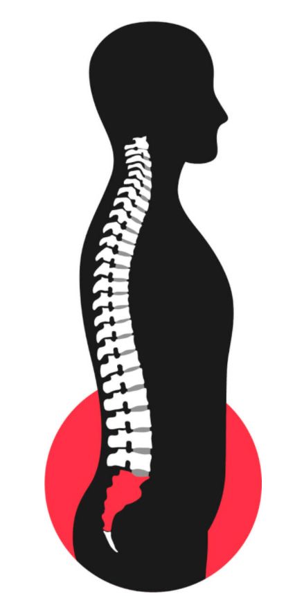 1 Kreuzbein Backpress®